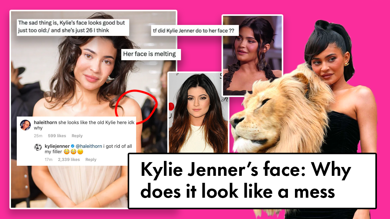 A picture of kylie jenner's old face and one of her face currently with some tweets around saying mean things about her apperance. Her picture with a dress with a lion's head on it in the foreground together with the text: Kylie Jenner's face: why does it seem like a mess